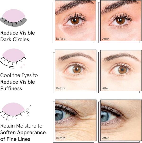 Grace & Stella Award Winning Under Eye Mask - Travel Essentials - Image 2