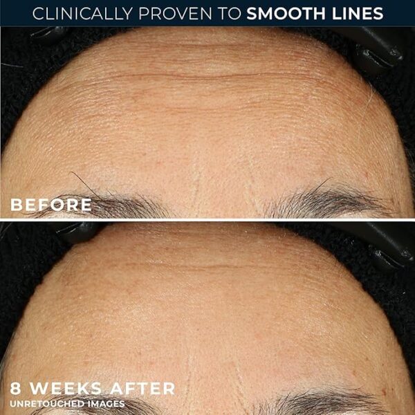 Best Retinol Night Serum for Wrinkles – RoC Retinol Correxion Anti-Aging Formula 2025 - Image 3
