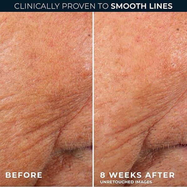Best Retinol Night Serum for Wrinkles – RoC Retinol Correxion Anti-Aging Formula 2025 - Image 2