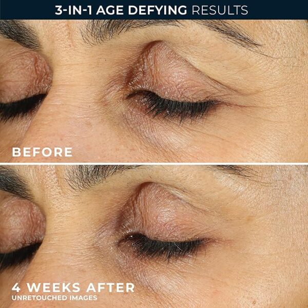 RoC Retinol Eye Cream for Dark Circles & Puffiness – Best Daily Anti-Aging 0 Wrinkle Treatment for Eyes - Image 2