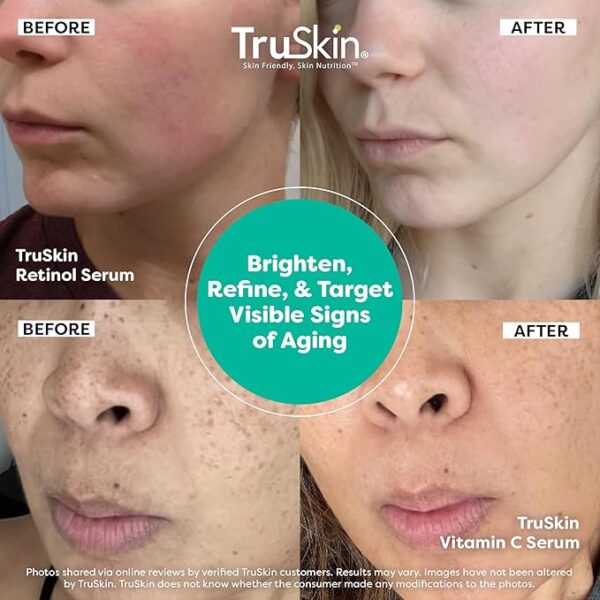 TruSkin Face Serum Duo – Best Vitamin C & Retinol for Smoother Skin 2025 - Image 2