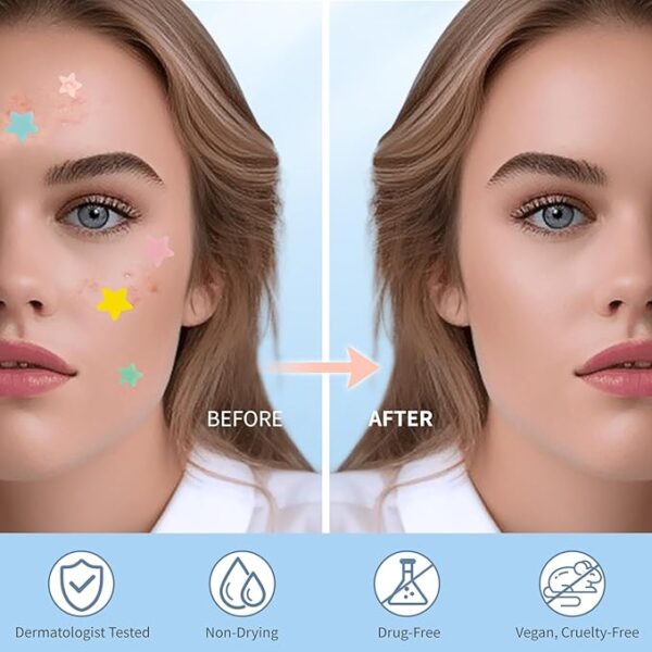 Fight Acne Fast with Cute Pimple Patches for Face – 200 Colorful Zit Covers with Tea Tree & Salicylic Acid - Image 3