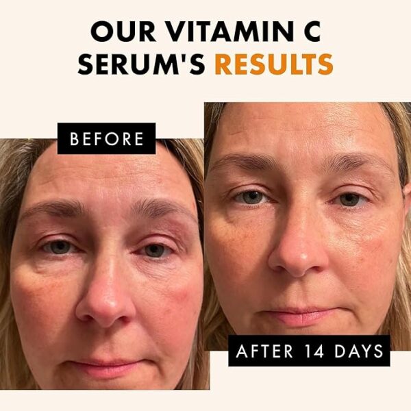 Eclat Vitamin C Face Serum – Ultimate Brightening, Anti-Aging Skincare, 30ml - Image 4