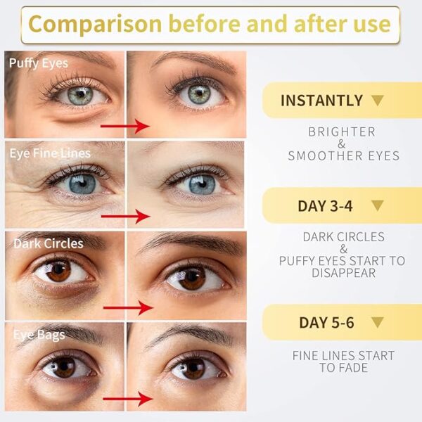 24K Gold Under Eye Patches – Collagen + Best Hyaluronic Boost Say Goodbye to Puffy Eyes - Image 3
