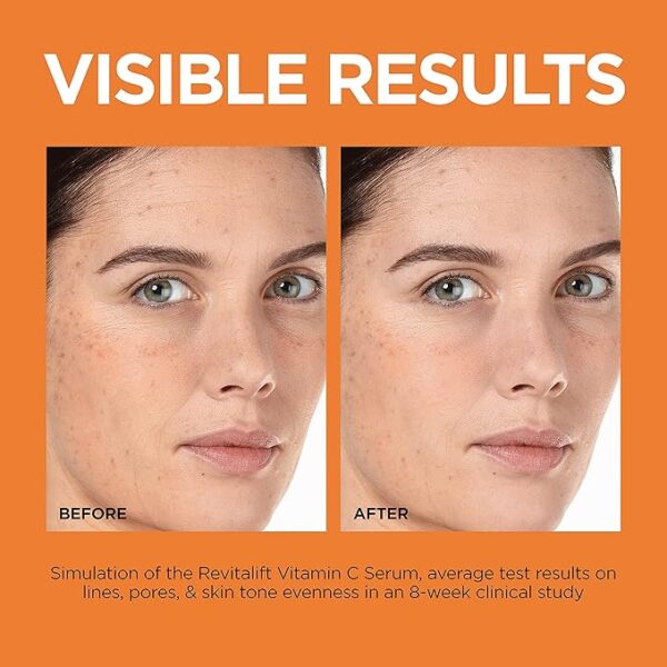 L'Oreal Revitalift Vitamin C Serum – Best Brightens & Smooths Skin, 1 oz - Image 2